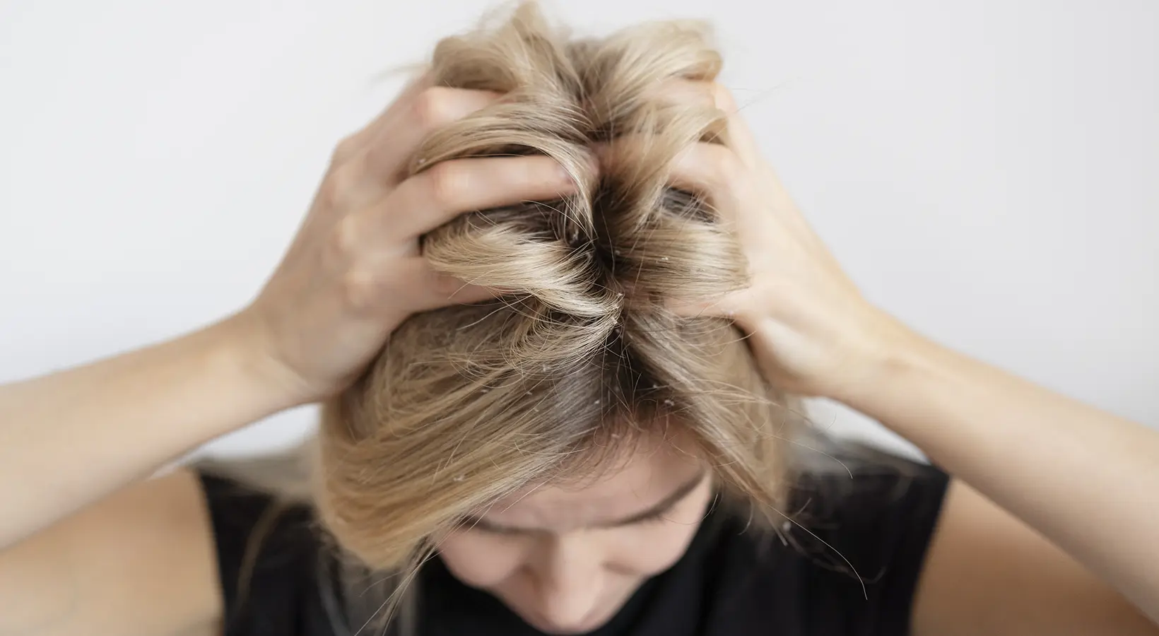 Pidocchi, il tabù che resiste: perché ne abbiamo ancora paura?